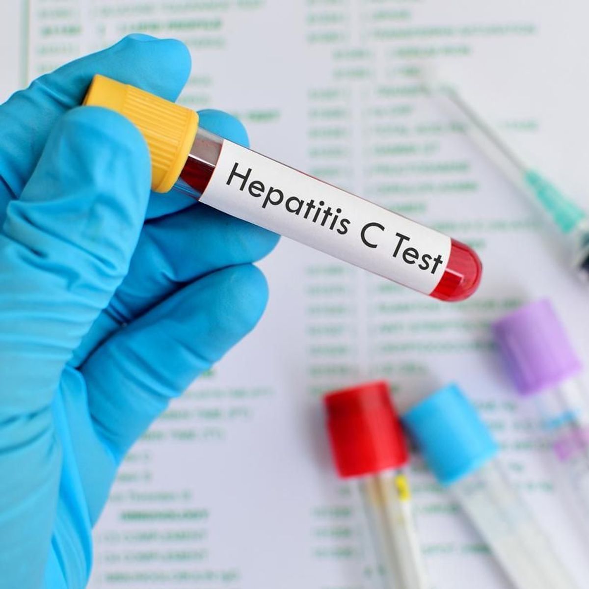 BIENTÔT DES TESTS DE DIAGNOSTIC DE L’HÉPATITE C, FABRIQUÉS AU MAROC
