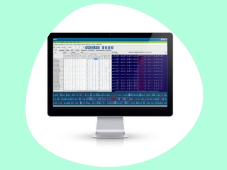 HSCRIBE Logiciel d'analyse pour Holter ECG