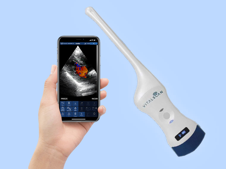 Echographe portable sans fil VitalScan VG / Gynécologues