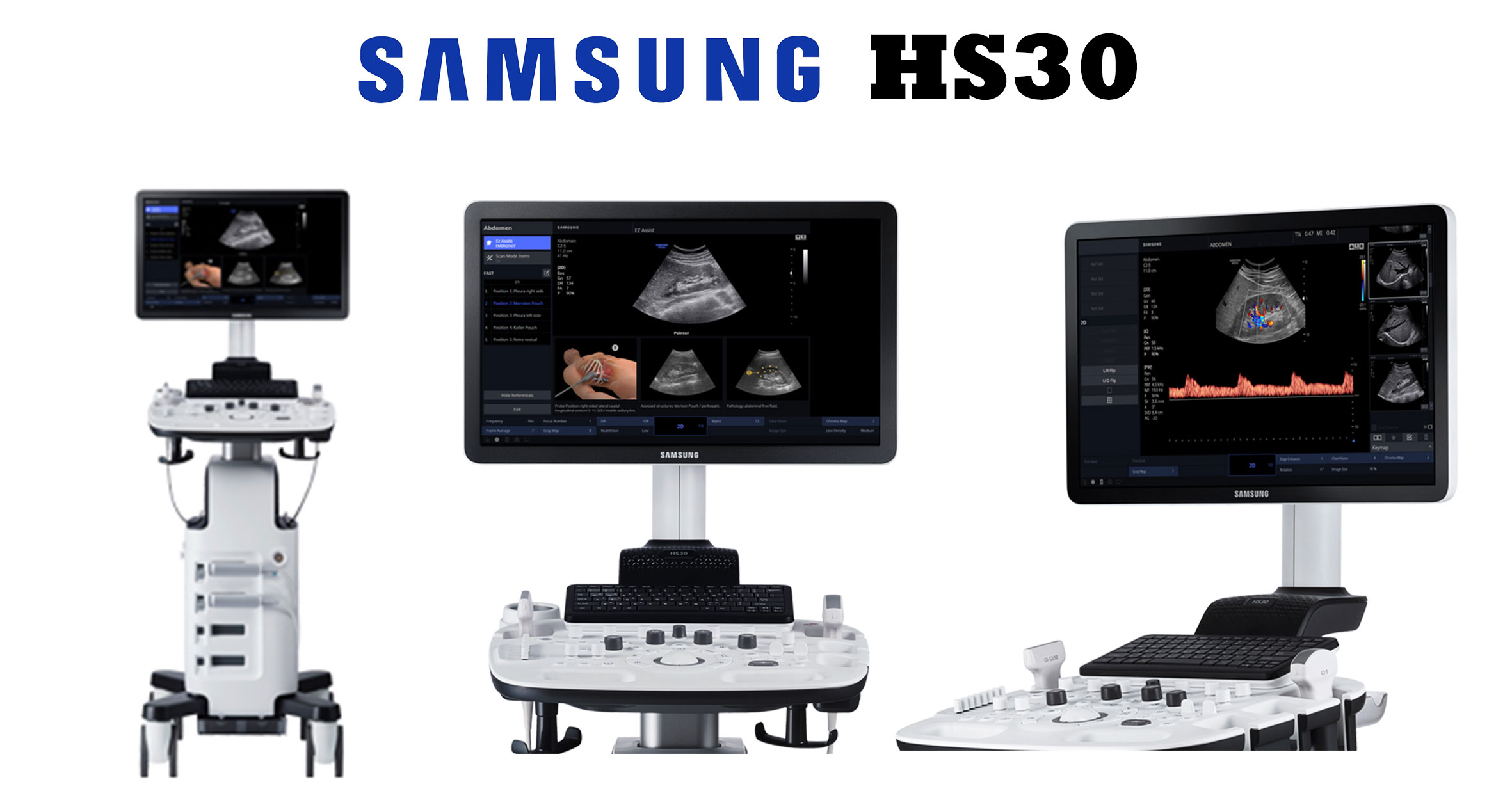 Echographe samsung HS30