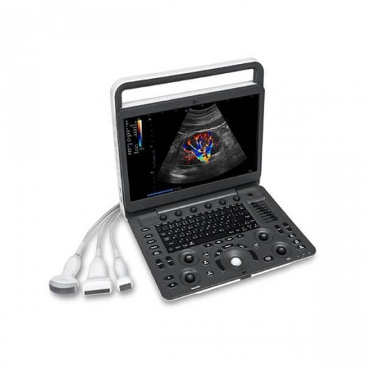 je cherche un échographe Sonoscape E2 doppler couleur